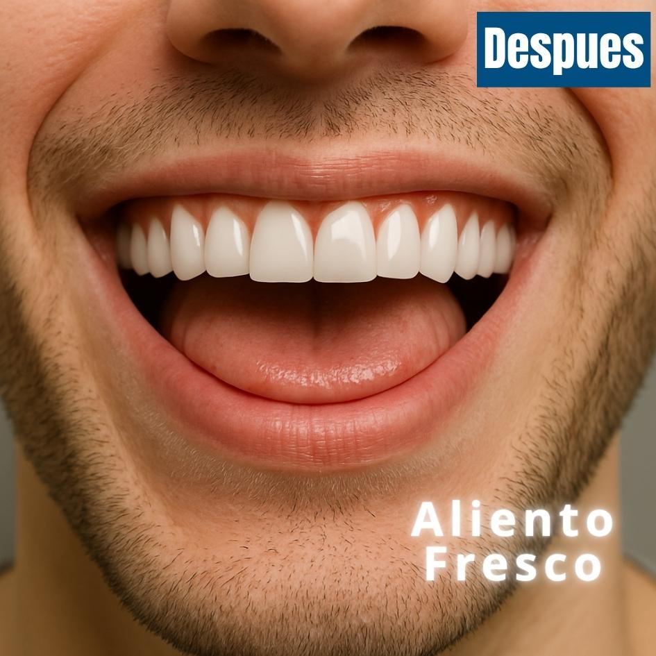 Antes